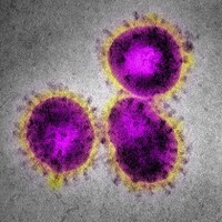 CORONAVIRUS - focus